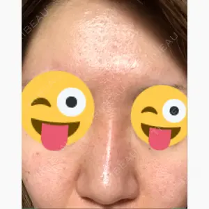 あらなみクリニック 静岡院口コミ