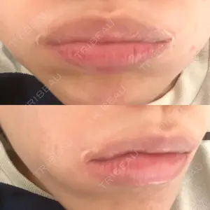 HB整形外科口コミ