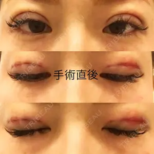 ヴェリィ美容形成クリニック口コミ