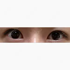 表参道タウン形成外科クリニック口コミ