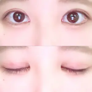 Lovelyan整形外科口コミ