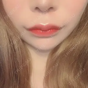 ライク整形外科口コミ
