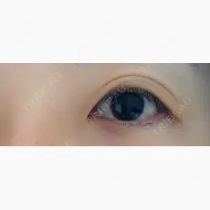 ティーズクリニック口コミ