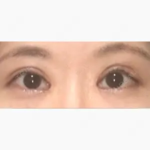 東京皮膚科・形成外科 (銀座いけだクリニック)口コミ