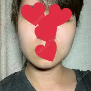 湘南美容クリニック 渋谷アネックス院口コミ