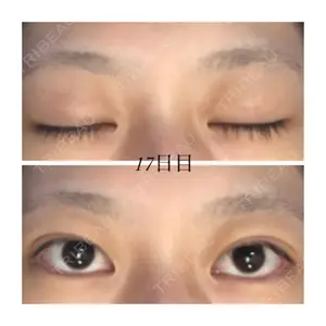 青森タウン形成外科クリニック口コミ