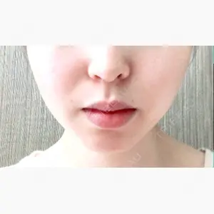 湘南美容クリニック 武蔵小杉院口コミ