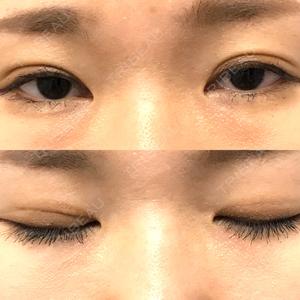 湘南美容クリニック 西葛西院口コミ