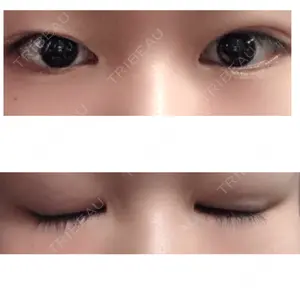 品川スキンクリニック京都院口コミ