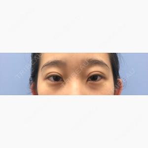 湘南美容クリニック 西葛西院口コミ