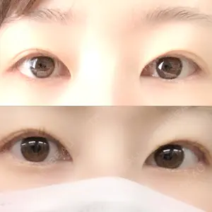 こいずみ形成クリニック名古屋口コミ