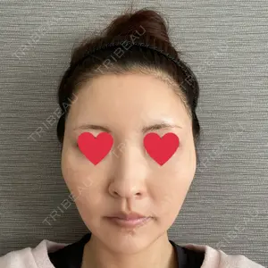 プルージュ美容クリニック 赤羽院口コミ