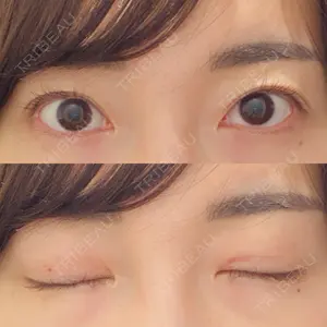 リビジョンクリニック（旧：池本形成外科・美容外科）口コミ