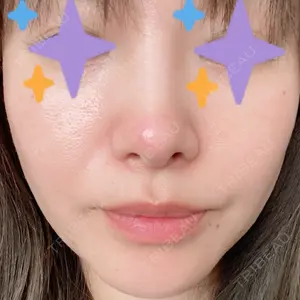 BIANCA銀座口コミ