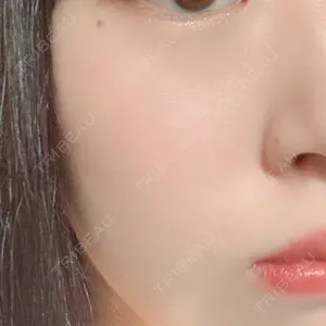 品川スキンクリニック大宮院口コミ