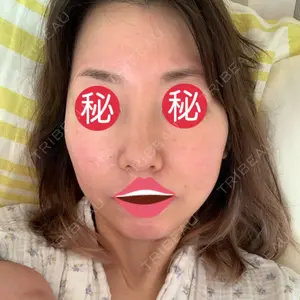 芦屋美容クリニック 銀座院口コミ