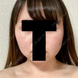 赤坂プレミアクリニック口コミ