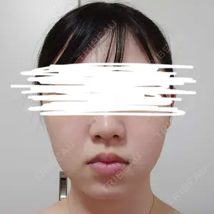 キルシェクリニック口コミ