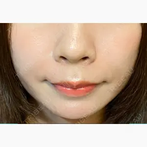 ミルディス皮フ科 北千住口コミ