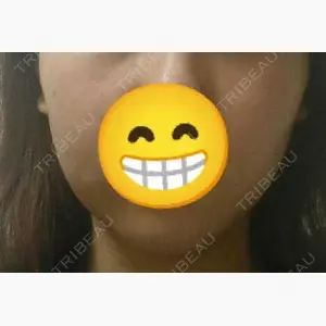 赤坂プレミアクリニック口コミ