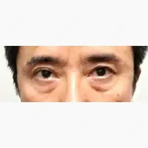 芦屋美容クリニック 銀座院口コミ