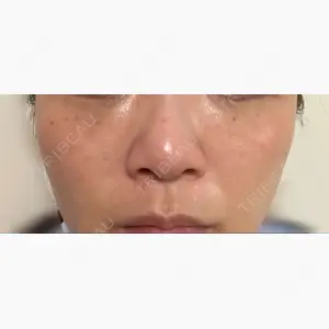 ベル美容外科クリニック口コミ