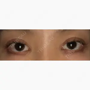 湘南美容クリニック 熊本院口コミ