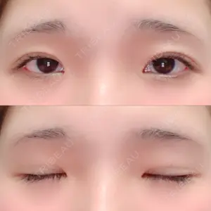 湘南美容クリニック 赤坂見附院口コミ