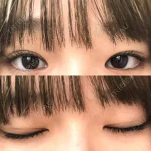高須クリニック 名古屋院口コミ