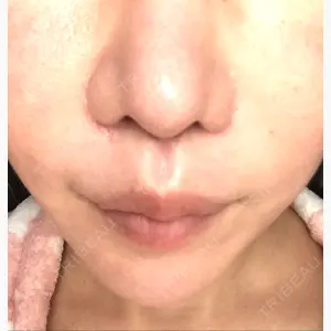 加藤クリニック麻布 東京院口コミ