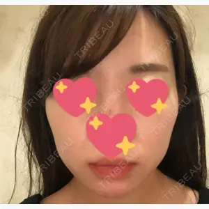 今泉スキンクリニック口コミ