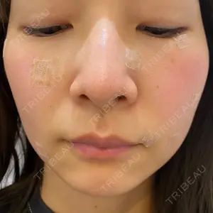 赤坂メディカルMクリニック口コミ