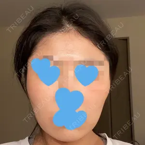 ビクアスクリニック口コミ
