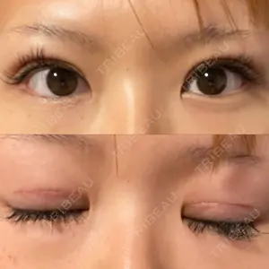 高須クリニック 横浜院口コミ