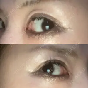 品川美容外科 梅田院口コミ