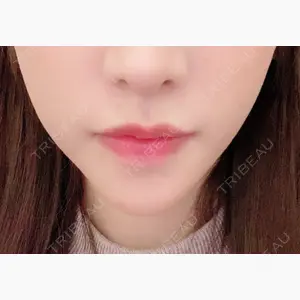 心斎橋コムロ美容外科クリニック口コミ