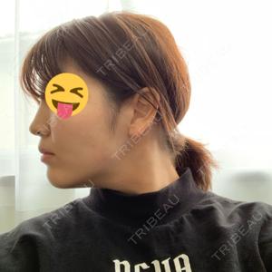湘南美容クリニック 新潟院口コミ
