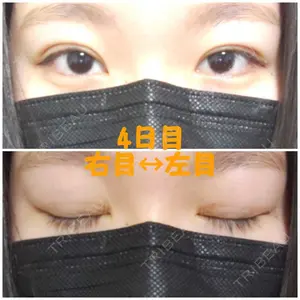 共立美容外科 大宮院口コミ