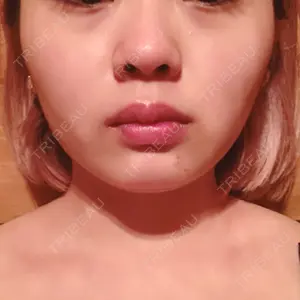 アサミ美容外科 渋谷院口コミ