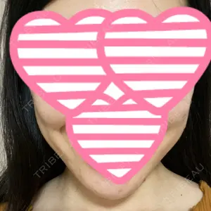 アサミ美容外科 大阪院口コミ