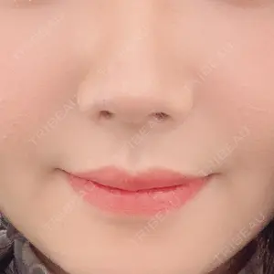 エイペックス美容外科口コミ