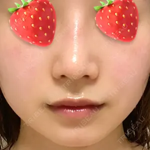 エイペックス美容外科口コミ
