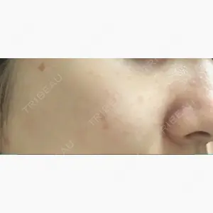 赤坂メディカルMクリニック口コミ