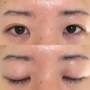 エイペックス美容外科口コミ