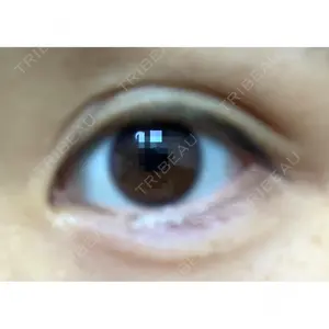 Wクリニック 梅田院口コミ