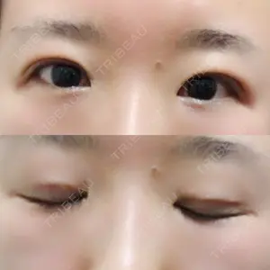 きくな湯田眼科口コミ