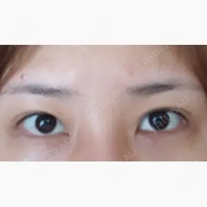 ティアラクリニック 川越院口コミ