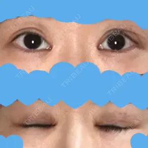 東京皮膚科・形成外科 (銀座いけだクリニック)口コミ
