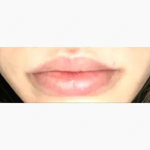 ナチュレ美容クリニック口コミ