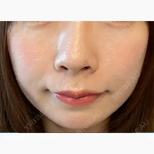 有楽町美容外科クリニック口コミ